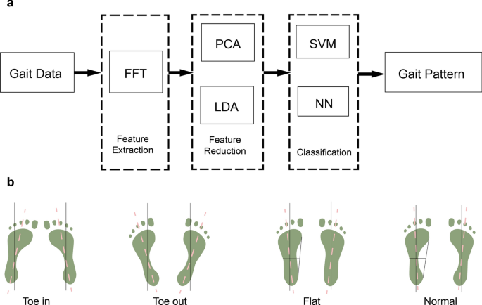科技重塑童鞋行业：智能监测、3D打印与环保材料，开启儿童足部健康新范式(图3)